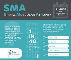 Hopes shine in the treatment of rare disease SMA in Bangladesh: Experts